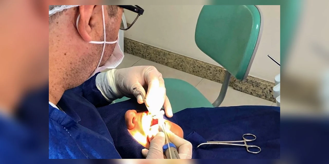 Mercado de implantes deve chegar a R$ 72 milhões em 2027