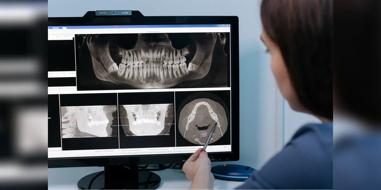 Com baixa penetração no mercado, planos odontológicos carecem de inovação