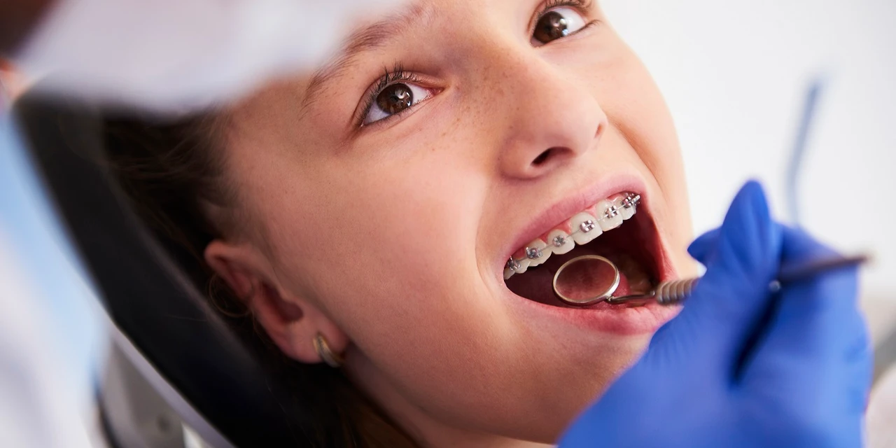 Julho Laranja promove a Ortodontia preventiva e os cuidados com a saúde bucal