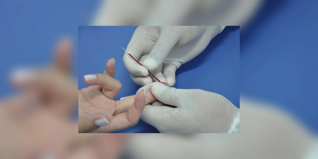 PG terá projeto para ampliar ações de prevenção e combate às IST´s
