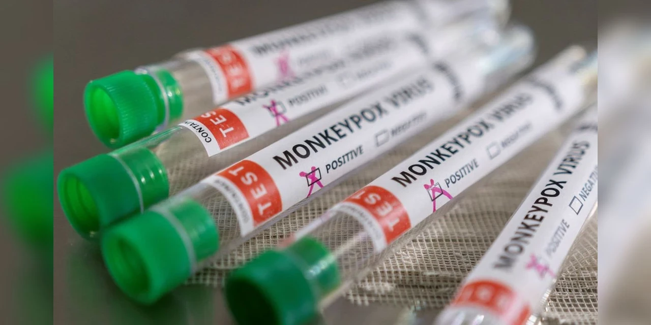 Secretaria da Saúde registra 11 novos casos de Mpox no Paraná