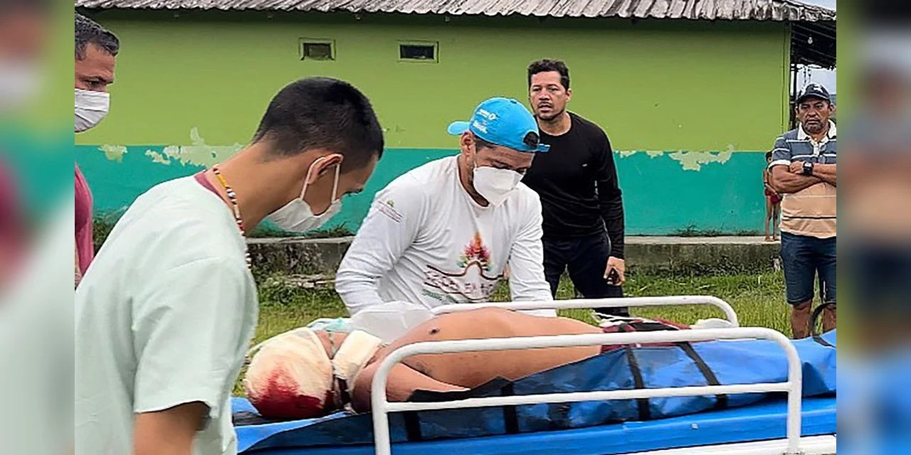 Em Roraima, um indígena é morto e dois são feridos em ataque na Terra Yanomami