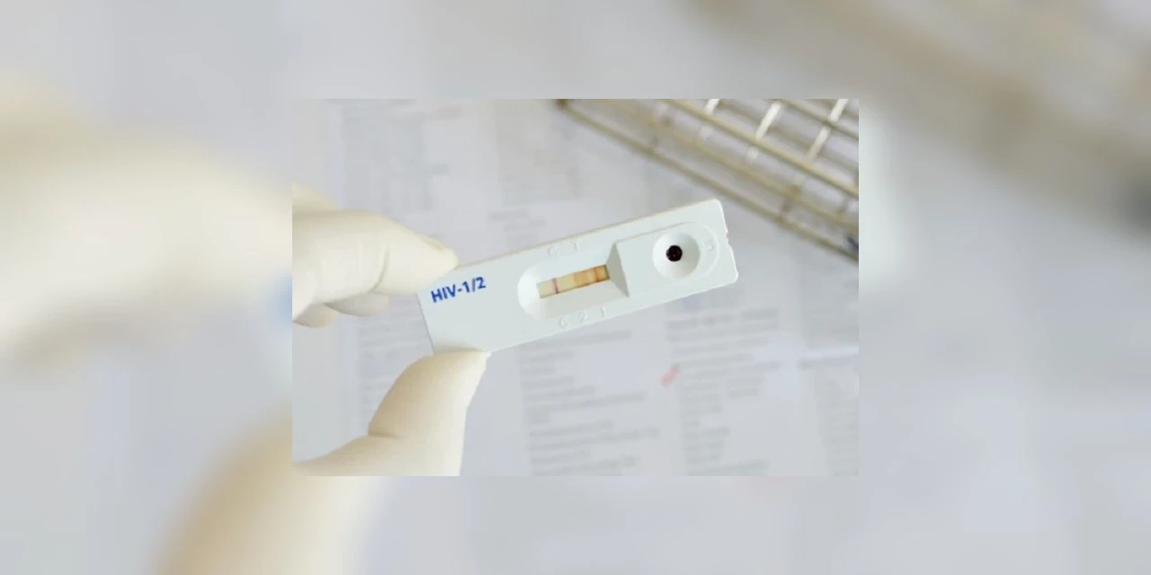 Dia Mundial de Luta Contra a AIDS em Ponta Grossa terá testagem rápida e orientações para a comunidade