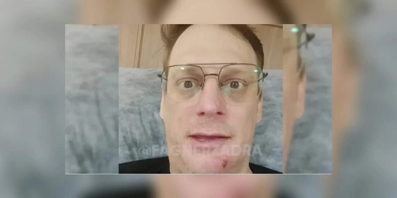 Humorista espreme espinha e vai parar em hospital em Curitiba