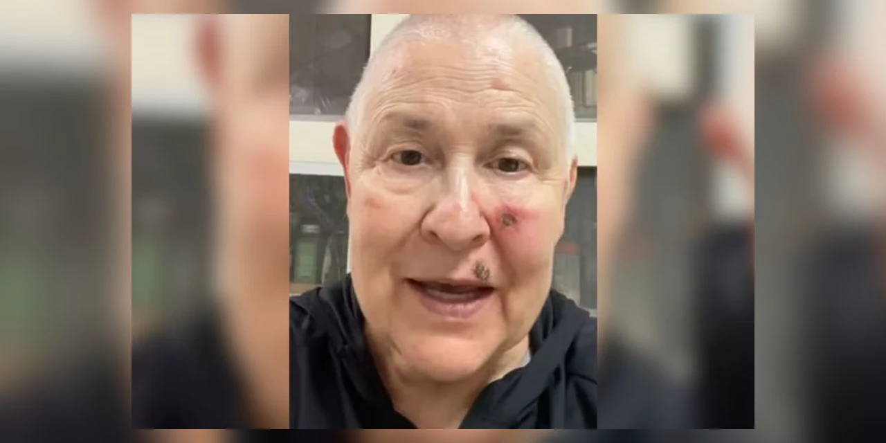 Monja Coen revela câncer e tranquiliza seguidores: "Estou no processo de cura"