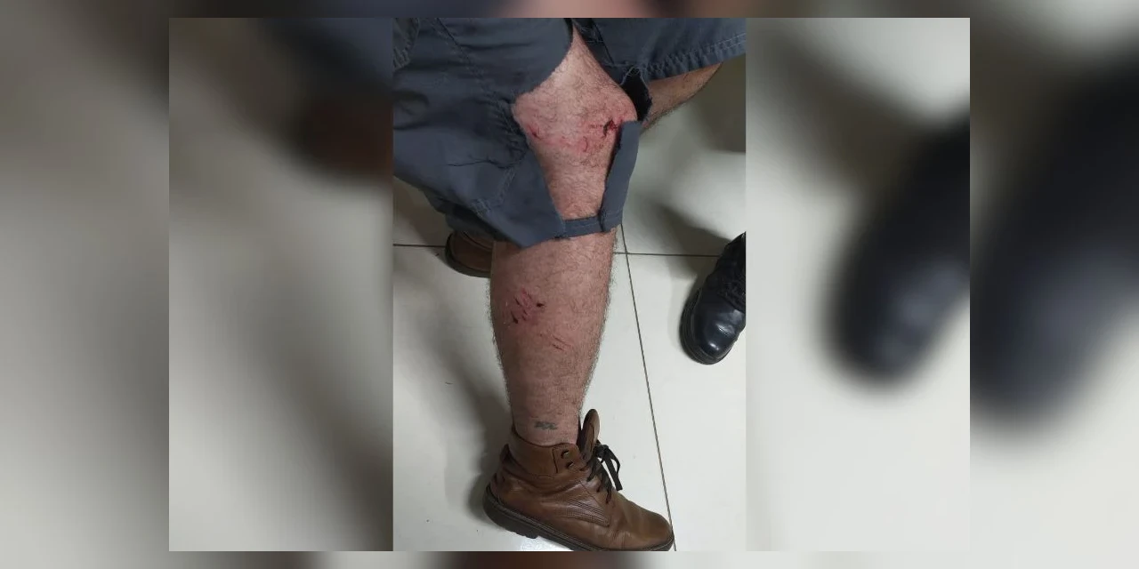 Tutor de pitbull é detido após animal atacar pedestre em PG