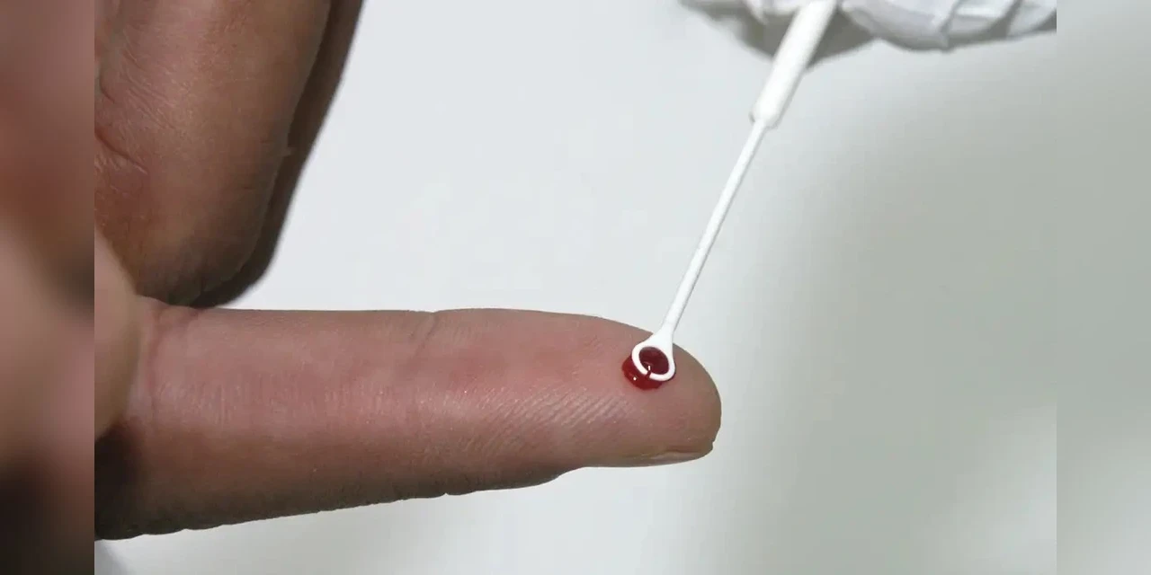 Saúde amplia vacinação contra o HPV para quem usa PrEP