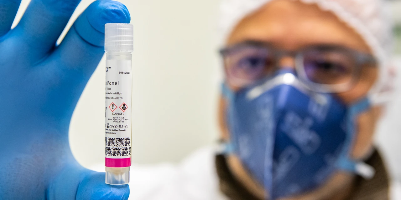 Em seis meses Lacen processa 13.298 amostras de vírus respiratórios