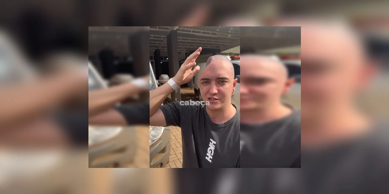 Paranaense vítima de acidente viraliza ao contar como teve parte do crânio guardada no abdômen