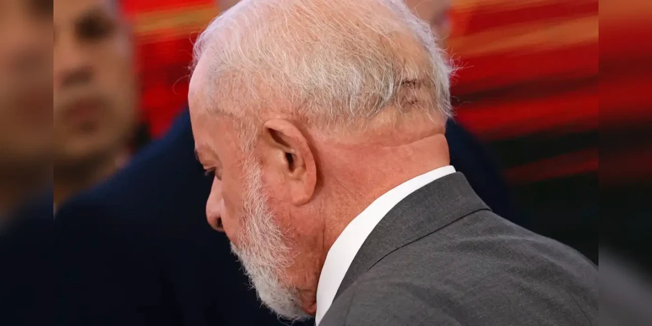 Lula tem dreno retirado e segue lúcido e bem, diz boletim médico