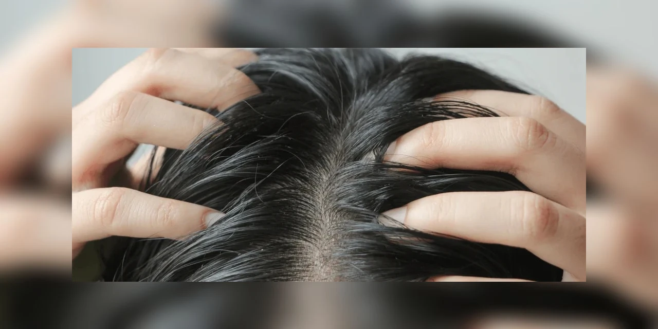 Confira dicas para disfarçar oleosidade do cabelo pela falta de banho