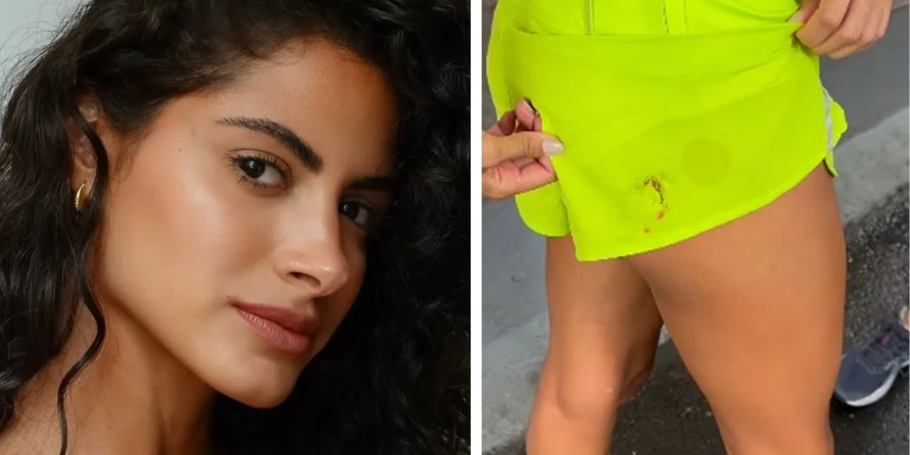 Atriz é atacada por cachorros em praia do RJ