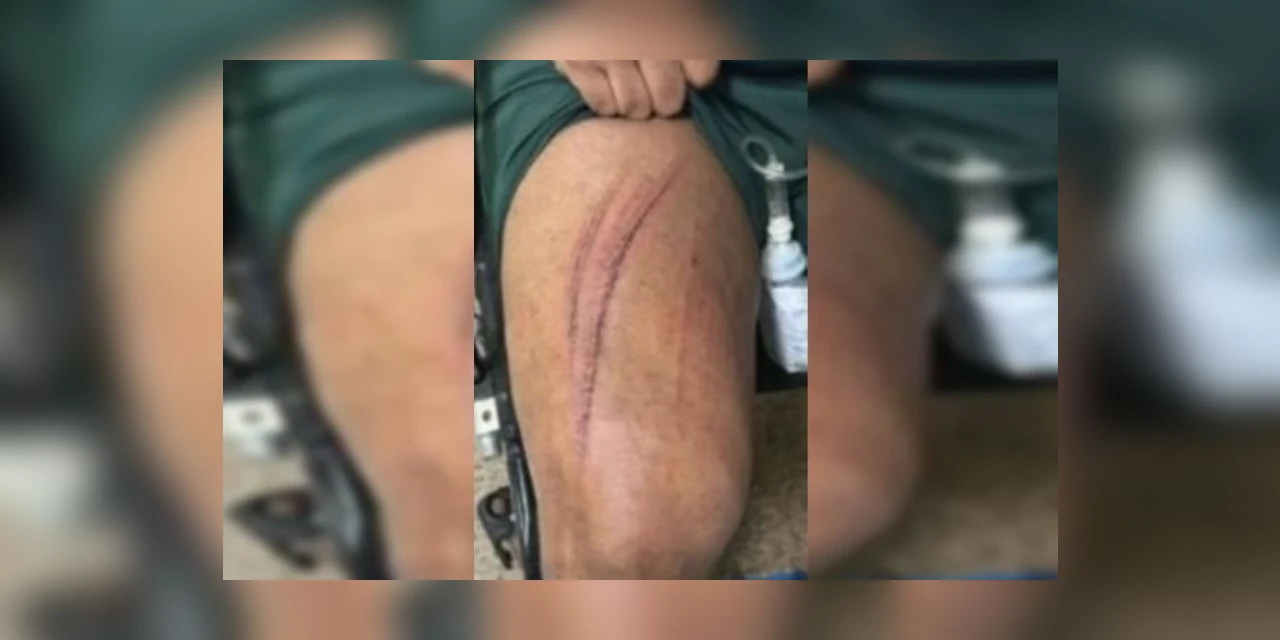 Prostituto é contratado para ménage e precisa fugir pela janela após ameaças