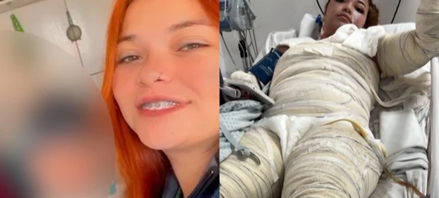 Família de jovem morta após queimaduras em banheira de motel suspeita de erro médico
