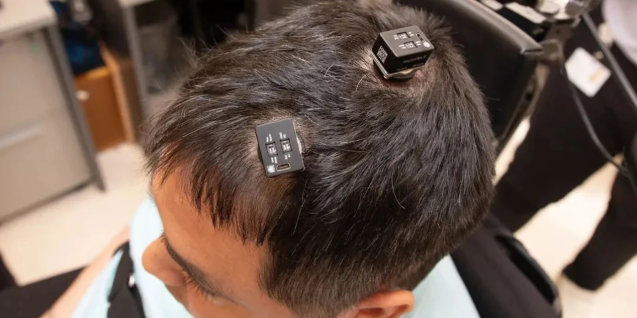 Homem tetraplégico sente e controla outra pessoa com implante cerebral e IA