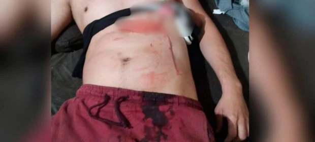Briga entre casal termina com marido esfaquado e mulher foragida