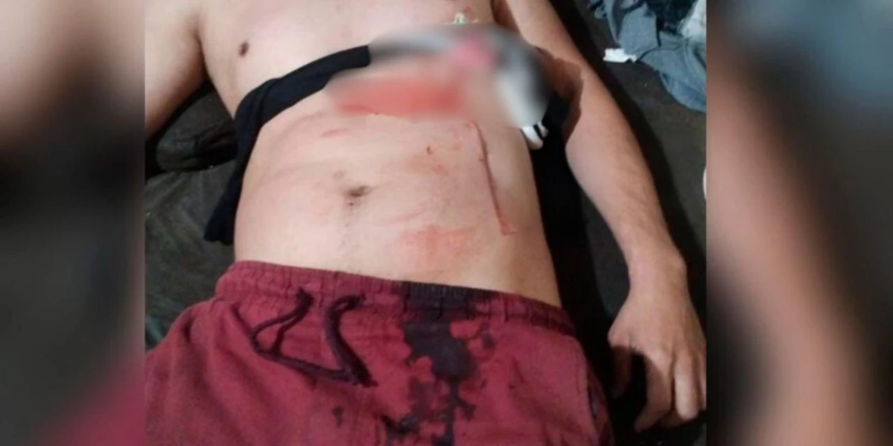 Briga entre casal termina com marido esfaquado e mulher foragida
