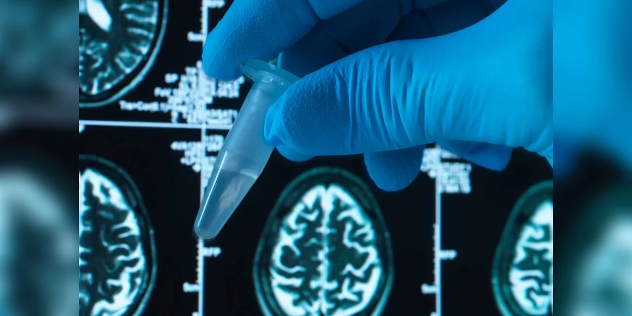 Cientistas brasileiros criam remédio promissor contra o Alzheimer