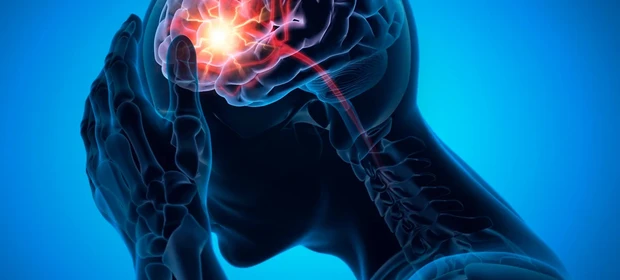 Especialistas alertam para sintomas precoces e diferenças nos sinais de AVC em mulheres