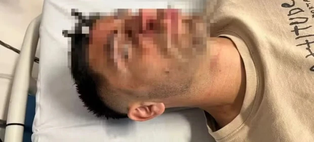 Jogador argentino é ferido com chave de carro cravada na testa após briga em jogo de futebol feminino sub-16