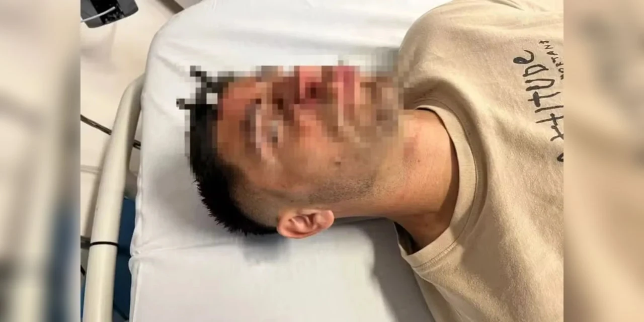 Jogador argentino é ferido com chave de carro cravada na testa após briga em jogo de futebol feminino sub-16