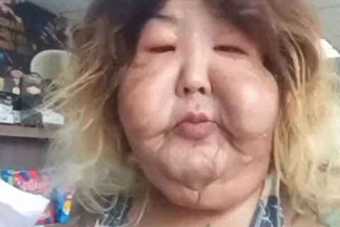 Veja como era Juju do Pix antes do procedimento estético que a prejudicou