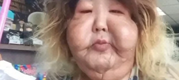 Veja como era Juju do Pix antes do procedimento estético que a prejudicou