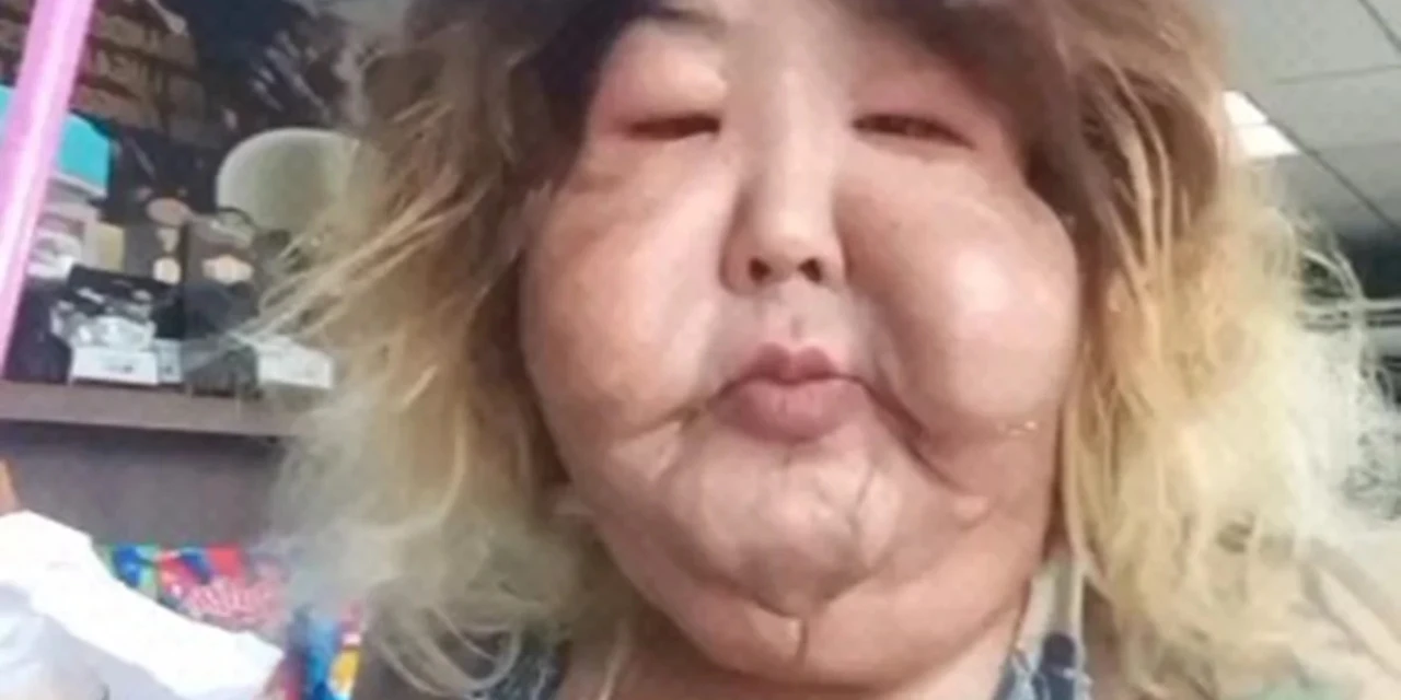 Veja como era Juju do Pix antes do procedimento estético que a prejudicou