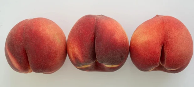 Estudo revela como o formato do glúteo pode indicar risco de diabetes tipo 2