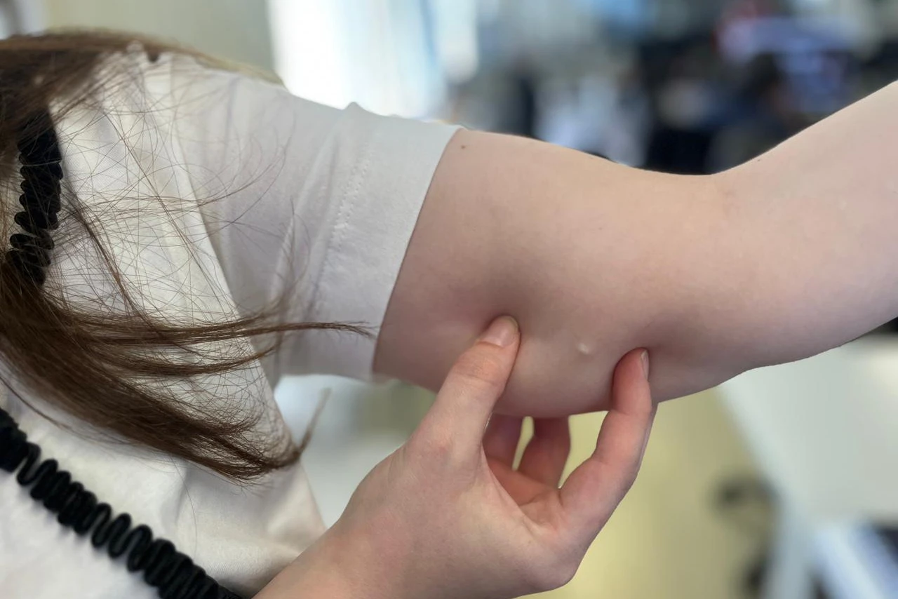 Foto: Divulgação/SESA