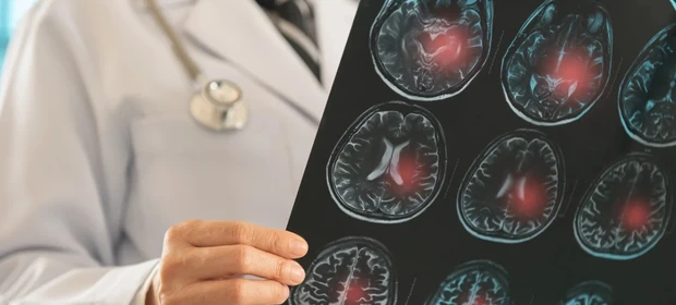 "OAB da Medicina": Senado aprova criação de exame nacional obrigatório para médicos